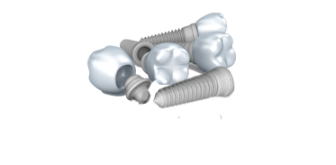 Dental Implants Image